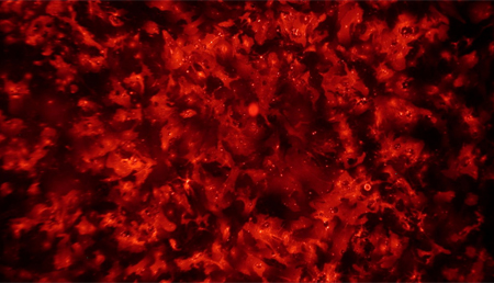 El canal de cloruro podría estar implicado en un proceso fisiopatológico alterado en la leucoencefalopatía megalencefálica