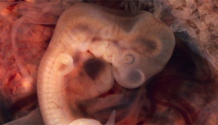 Descubren un gen que protege de las malformaciones causadas por la diabetes materna durante la gestación