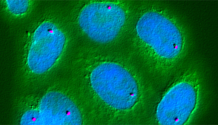 Dan un paso más en la comprensión de la inestabilidad del genoma humano