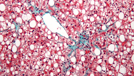 La regulación de la PASK podría regular el desarrollo del sobrepeso y obesidad