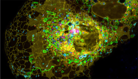 Identifican una mutación en un transportador mitocondrial que causa el síndrome de Fontaine