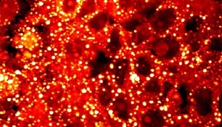 Algoritmos matemáticos para atacar el metabolismo del cáncer