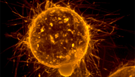 El gen Spns2, nueva posible diana terapéutica para hacer frente a la generación de metástasis