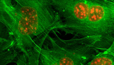 Identifican una nueva función en levaduras para la degradación de proteínas que podría tener implicaciones en el cáncer