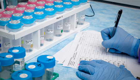 Nuevo método para la determinación de calcio en micro-muestras biológicas