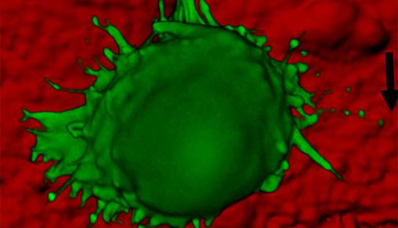 Una proteína permite reparar las roturas del ADN causadas por la quimioterapia