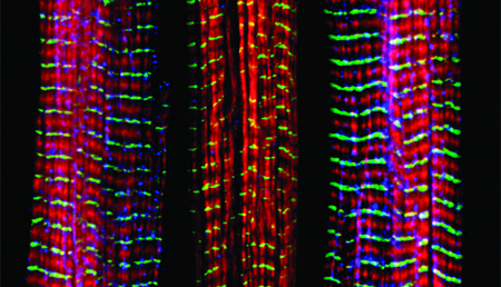 Descubren un papel protector ‘inesperado’ de un subtipo de células del sistema inmune frente a la aterosclerosis