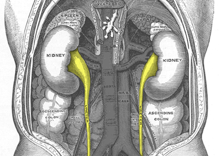 Causas genéticas de los defectos en el tracto urinario y riñones en el síndrome de DiGeorge